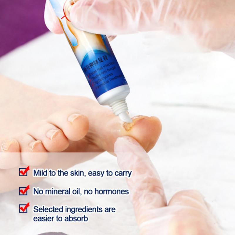 Sumifun Nail Fungus Removal Cream for Toenail Repair
