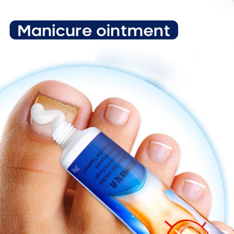Sumifun Nail Fungus Removal Cream for Toenail Repair