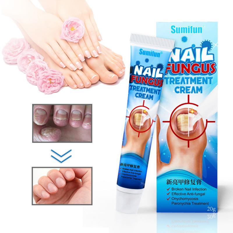Sumifun Nail Fungus Removal Cream for Toenail Repair