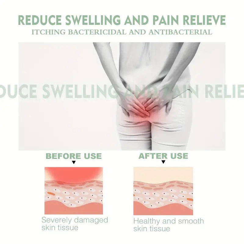 Hemorrhoids Relief Cream for Pain and Itching Relief
